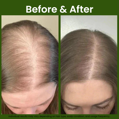 Confidita's Organic Rosemary Hair Growth Shampoo