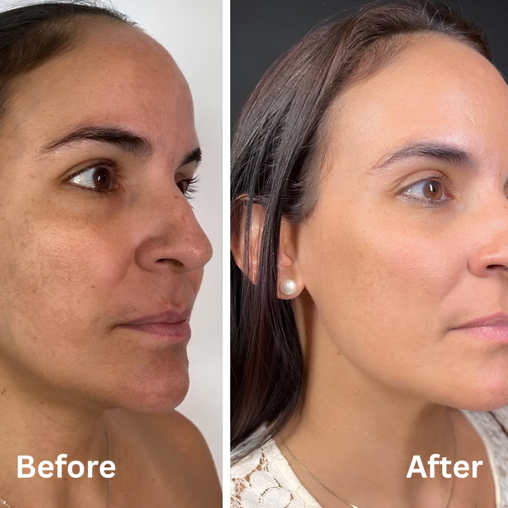 Confidita's Beauty Peel Shot - White + Black Rice Set