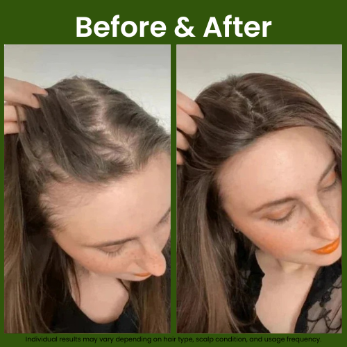 Confidita's Organic Rosemary Hair Growth Shampoo