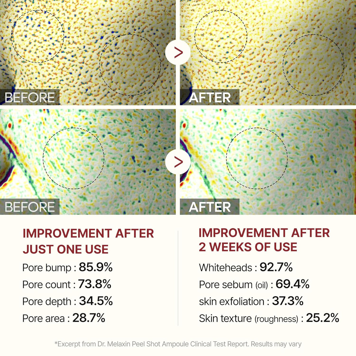 Confidita's Beauty Peel Shot - White + Black Rice Set