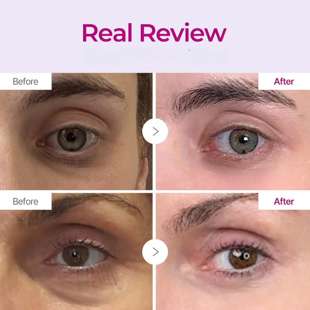 Cemenrete Calcium — Dark Circle Eye Repair Cream